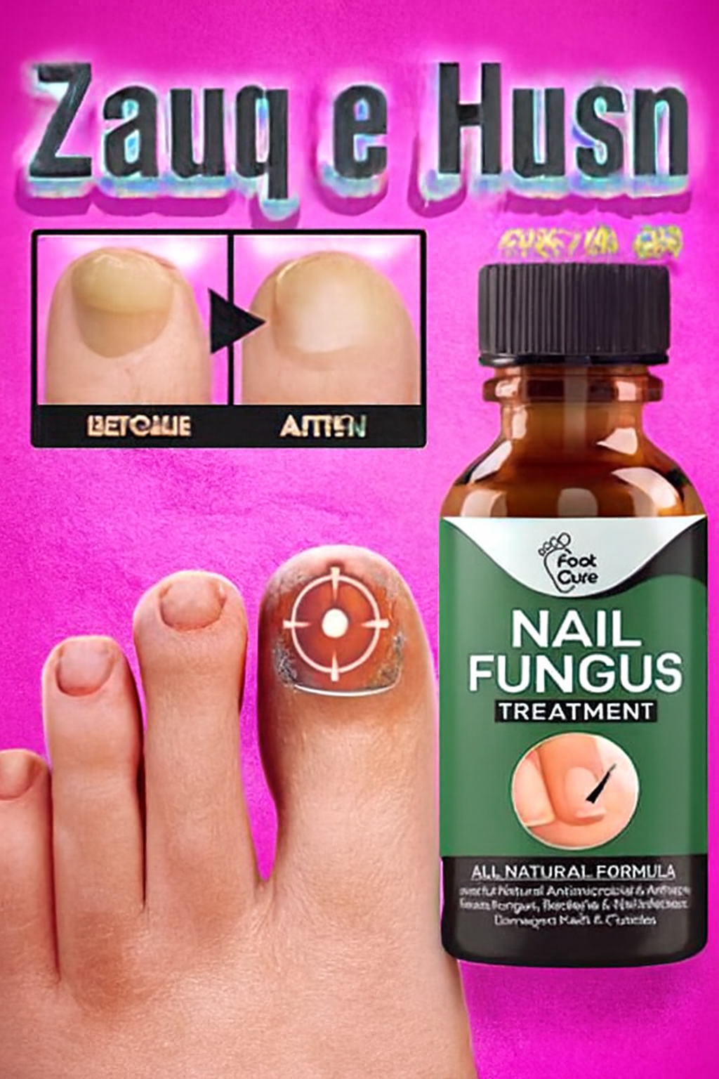 Fast Nail Fungal Treatment – Nail Repair Essence Serum & Foot Nail Fungus Removal Gel