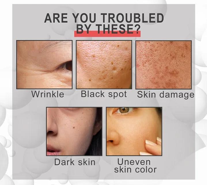 Blemish Removal Retinol Serum – 15ml