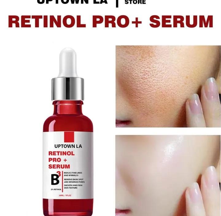 Blemish Removal Retinol Serum – 15ml