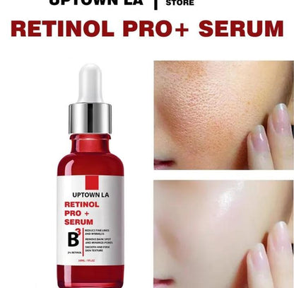 Blemish Removal Retinol Serum – 15ml