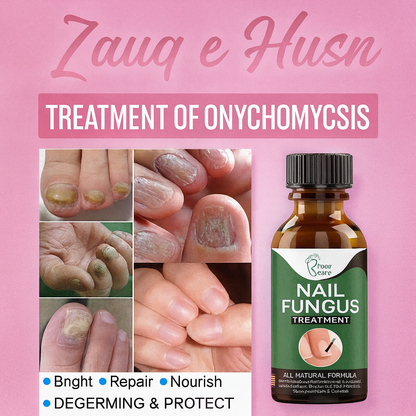 Fast Nail Fungal Treatment – Nail Repair Essence Serum & Foot Nail Fungus Removal Gel - Foot Cure