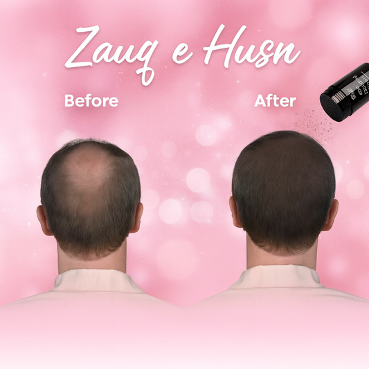 Hair Building Fibers Instant Hair Thickener for Men & Women - Dexe