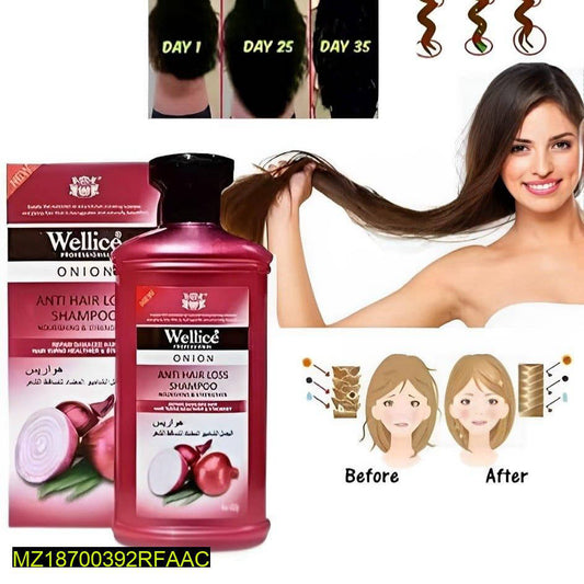 Onion Anti-Hair Loss Shampoo – 400ml for Hair Growth & Repair